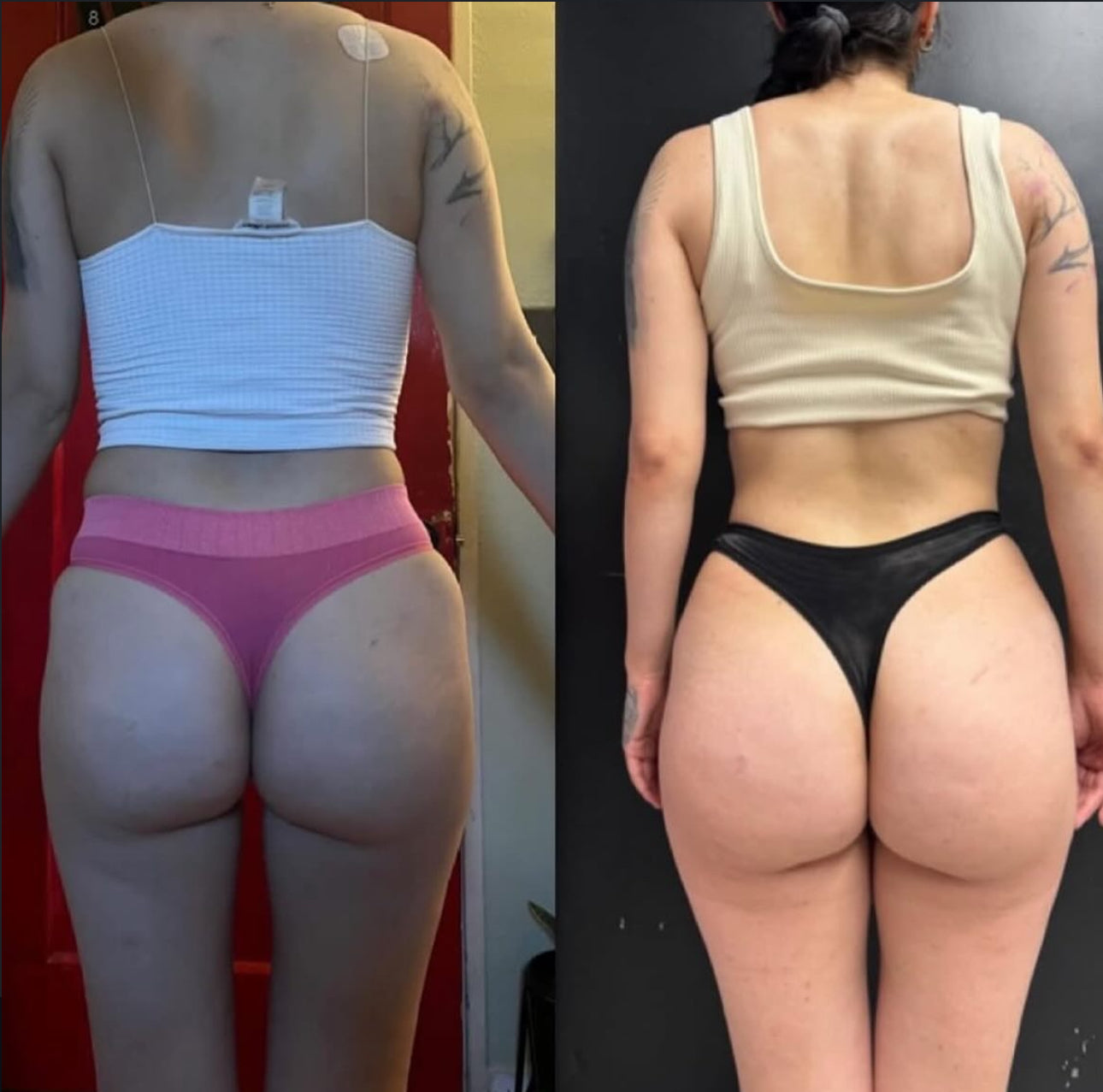 Sekrè Dash BBL Duo – Curve Enhancer & Glow Oil Massage